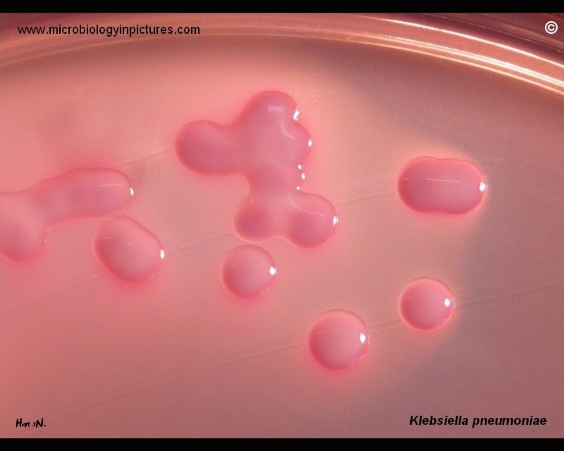appearance of K.pneumoniae colonies on agar